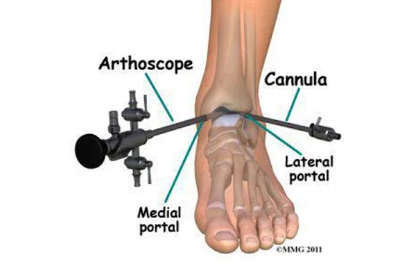 Glyra Orthopaedics