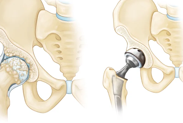 Glyra Orthopaedics