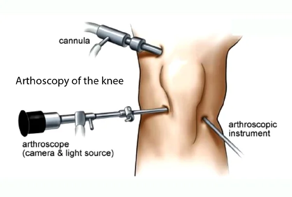 Glyra Orthopaedics