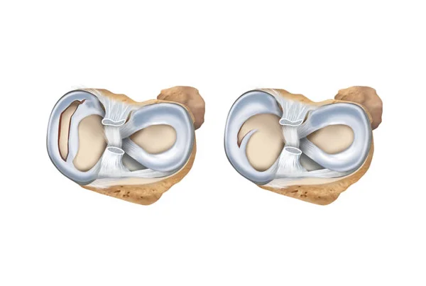 Glyra Orthopaedics