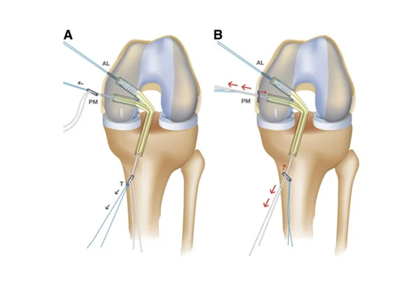 Glyra Orthopaedics