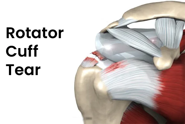 Glyra Orthopaedics