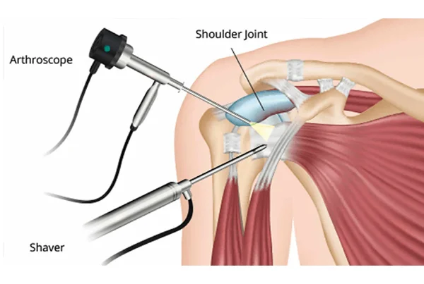 Glyra Orthopaedics