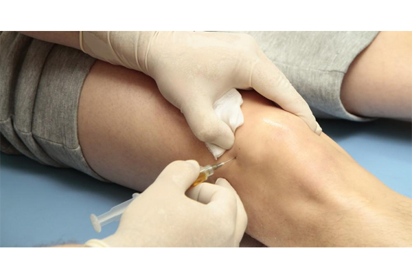 PRP Injections